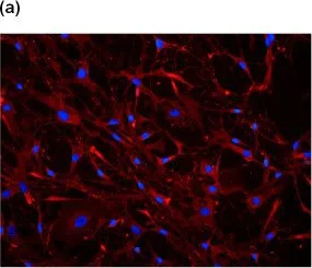 Immunocytochemistry/ Immunofluorescence - Anti-Collagen II antibody (AB34712)