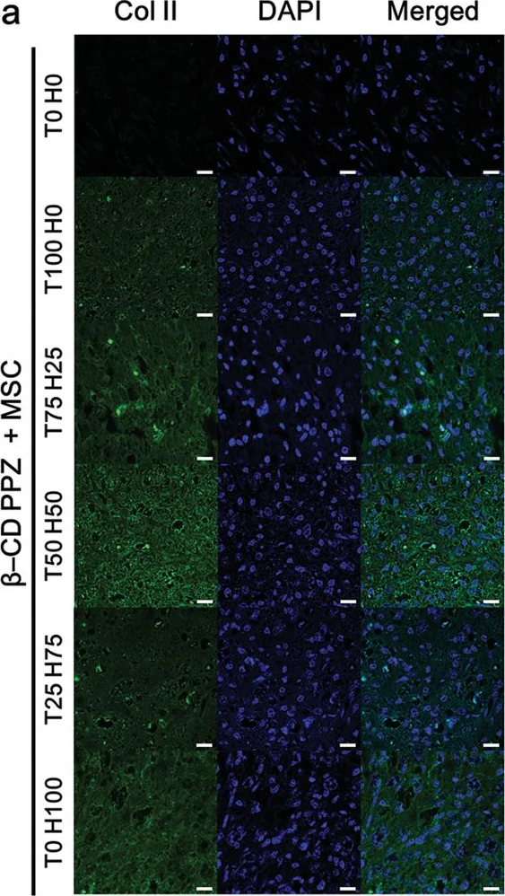 Immunocytochemistry/ Immunofluorescence - Anti-Collagen II antibody (AB34712)