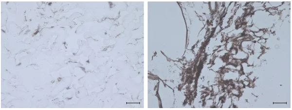 Immunohistochemistry (Formalin/PFA-fixed paraffin-embedded sections) - Anti-Collagen II antibody (AB34712)
