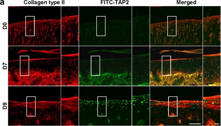 Anti-collagen II antibody - rabbit polyclonal (ab34712) | Abcam