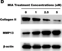 Western blot - Anti-Collagen II antibody (AB34712)