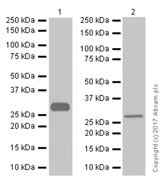Western blot - Anti-Collagen II antibody [EPR12268] (AB188570), expandable thumbnail