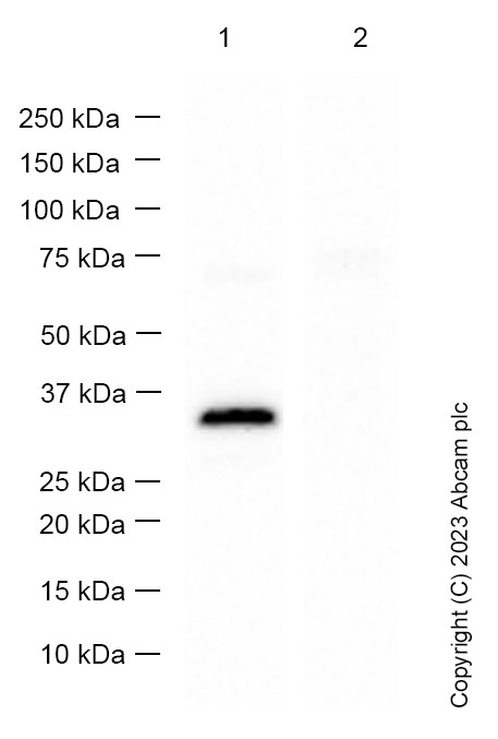 Western blot - Anti-Collagen II antibody [EPR12268] (AB188570), expandable thumbnail