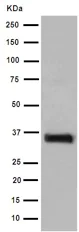 Western blot - Anti-Collagen II antibody [EPR12268] (AB188570)