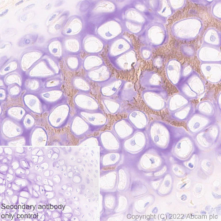Immunohistochemistry (Formalin/PFA-fixed paraffin-embedded sections) - Anti-Collagen II antibody [EPR27418-25] (AB307674)