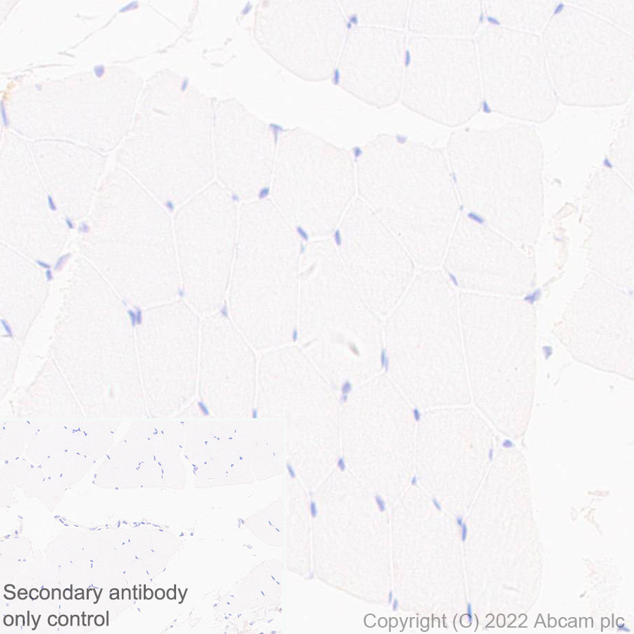 Immunohistochemistry (Formalin/PFA-fixed paraffin-embedded sections) - Anti-Collagen II antibody [EPR27418-25] (AB307674)