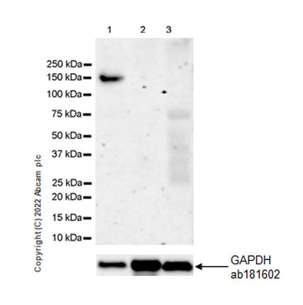 Western blot - Anti-Collagen II antibody [EPR27418-25] (AB307674)