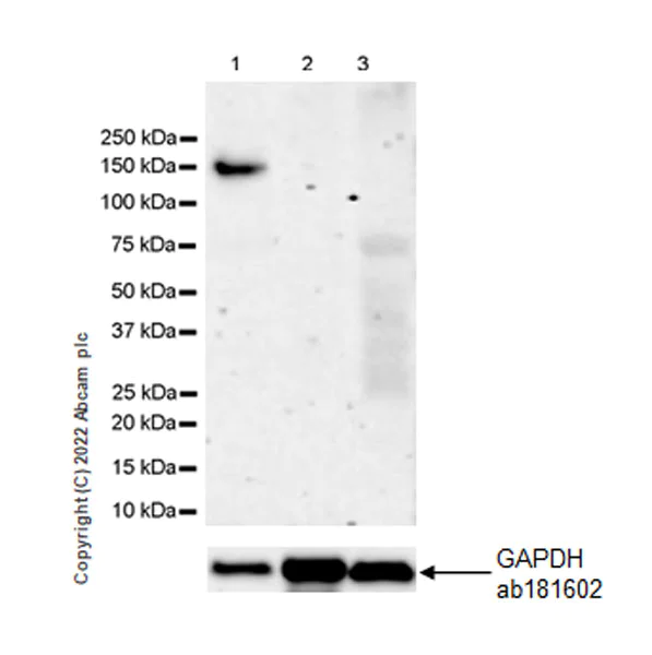 Western blot - Anti-Collagen II antibody [EPR27418-25] (AB307674)