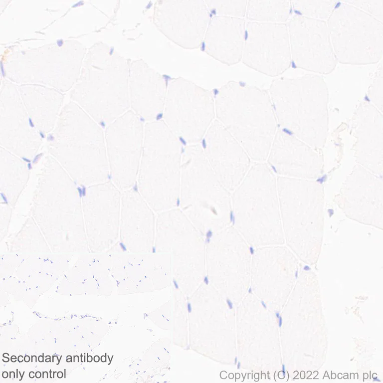 Immunohistochemistry (Formalin/PFA-fixed paraffin-embedded sections) - Anti-Collagen II antibody [EPR27418-25] - BSA and Azide free (AB307675)