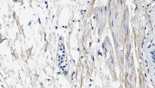 Immunohistochemistry (Formalin/PFA-fixed paraffin-embedded sections) - Anti-Collagen III antibody [1E7-D7/Col3] (AB23445)