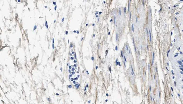 Immunohistochemistry (Formalin/PFA-fixed paraffin-embedded sections) - Anti-Collagen III antibody [1E7-D7/Col3] (AB23445)