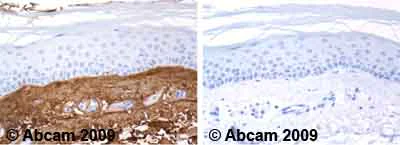 Immunohistochemistry (Formalin/PFA-fixed paraffin-embedded sections) - Anti-Collagen III antibody (AB7778)