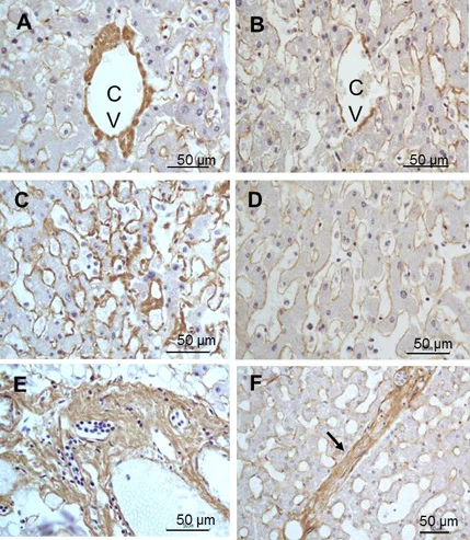 Immunohistochemistry (Formalin/PFA-fixed paraffin-embedded sections) - Anti-Collagen III antibody (AB7778)