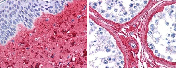 Immunohistochemistry (Formalin/PFA-fixed paraffin-embedded sections) - Anti-Collagen III antibody (AB7778)