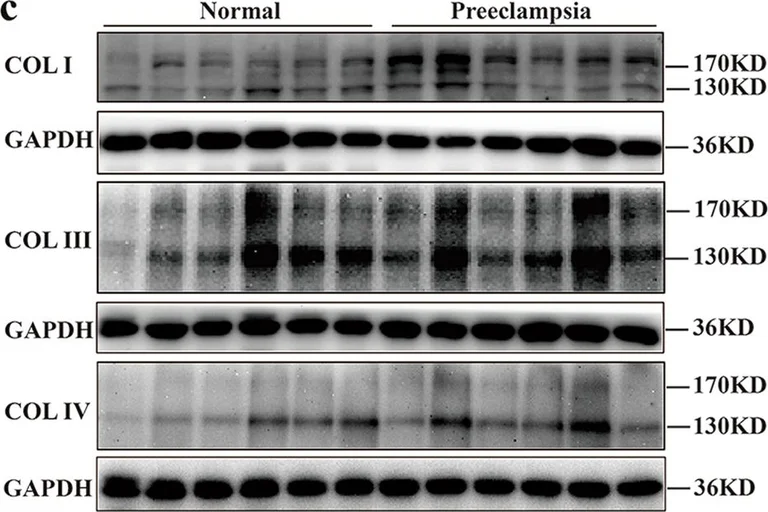 Western blot - Anti-Collagen III antibody (AB7778)