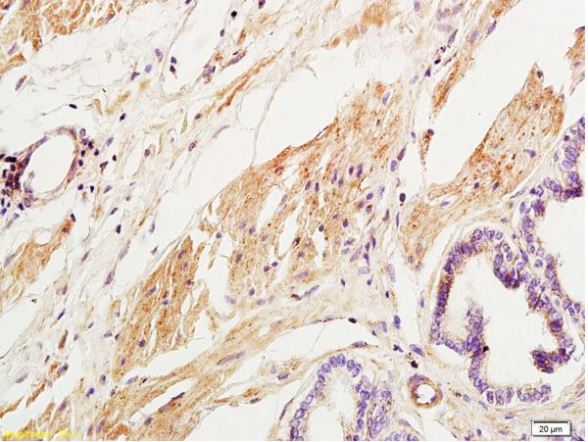 Immunohistochemistry (Formalin/PFA-fixed paraffin-embedded sections) - Anti-Collagen III antibody - C-terminal (AB216430), expandable thumbnail