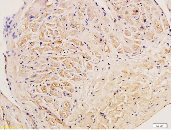 Immunohistochemistry (Formalin/PFA-fixed paraffin-embedded sections) - Anti-Collagen III antibody - C-terminal (AB216430), expandable thumbnail