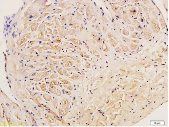 Immunohistochemistry (Formalin/PFA-fixed paraffin-embedded sections) - Anti-Collagen III antibody - C-terminal (AB216430)