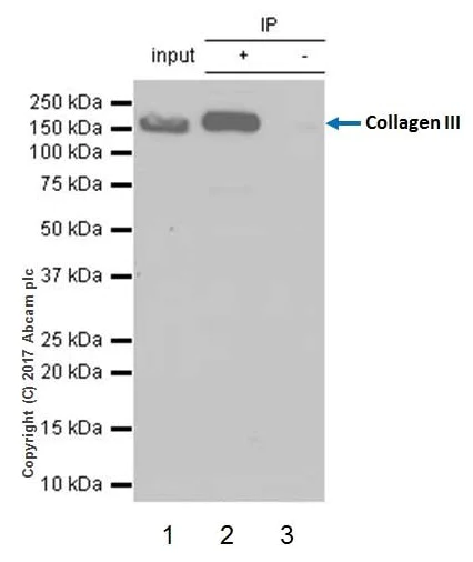 Immunoprecipitation - Anti-Collagen III antibody [EPR17673] (AB184993)