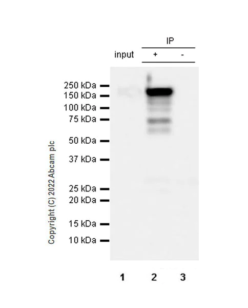Immunoprecipitation - Anti-Collagen III antibody [EPR17673] (AB184993)