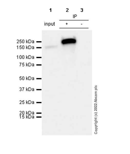 Immunoprecipitation - Anti-Collagen III antibody [EPR17673] (AB184993)