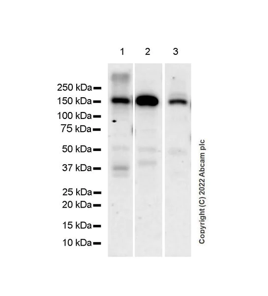Western blot - Anti-Collagen III antibody [EPR17673] (AB184993)