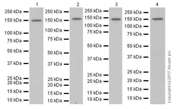Western blot - Anti-Collagen III antibody [EPR17673] (AB184993)