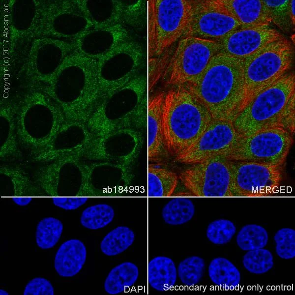 Immunocytochemistry/ Immunofluorescence - Anti-Collagen III antibody [EPR17673] - BSA and Azide free (AB224532)