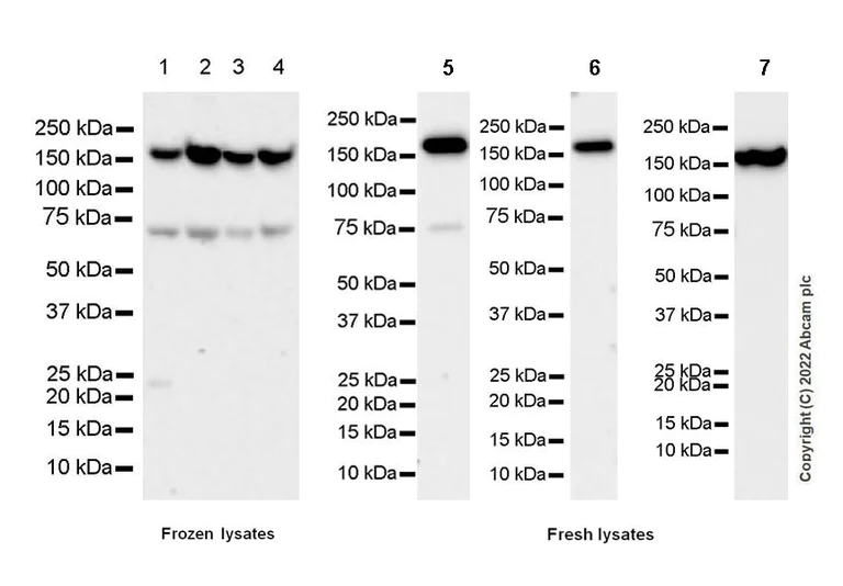 Western blot - Anti-Collagen III antibody [EPR17673] - BSA and Azide free (AB224532)