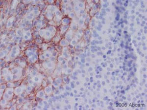Immunohistochemistry (Formalin/PFA-fixed paraffin-embedded sections) - Anti-Collagen III antibody [FH-7A] (AB6310)