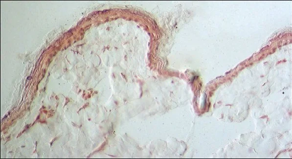 Immunohistochemistry (Frozen sections) - Anti-Collagen III antibody [FH-7A] (AB6310)