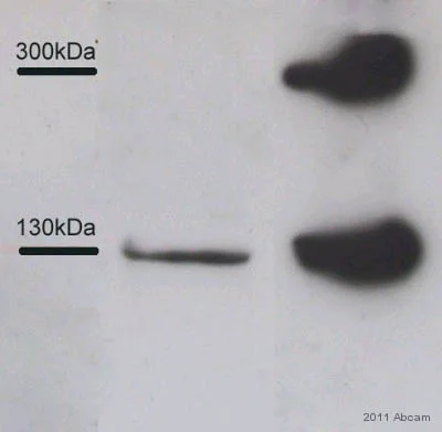 Western blot - Anti-Collagen III antibody [FH-7A] (AB6310)