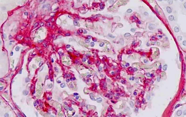 Immunohistochemistry (Formalin/PFA-fixed paraffin-embedded sections) - Anti-Collagen IV alpha 1 antibody (AB189408)