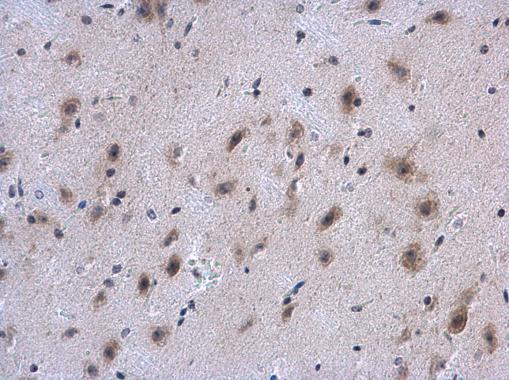 Immunohistochemistry (Formalin/PFA-fixed paraffin-embedded sections) - Anti-Collagen IV alpha 1 antibody - N-terminal (AB227616)