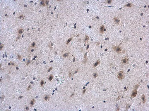 Immunohistochemistry (Formalin/PFA-fixed paraffin-embedded sections) - Anti-Collagen IV alpha 1 antibody - N-terminal (AB227616)