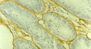 Immunohistochemistry (Formalin/PFA-fixed paraffin-embedded sections) - Anti-Collagen IV antibody [1043] (AB86042)