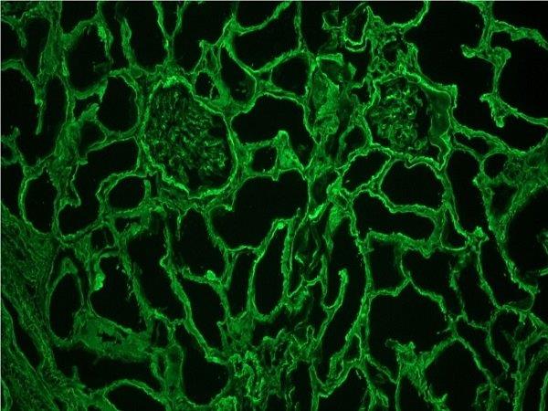 Immunohistochemistry (Frozen sections) - Anti-Collagen IV antibody [1043] (AB86042)