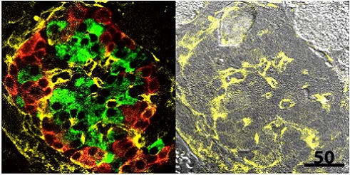 Immunohistochemistry (Formalin/PFA-fixed paraffin-embedded sections) - Anti-Collagen IV antibody (AB19808), expandable thumbnail