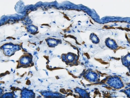 Immunohistochemistry (Formalin/PFA-fixed paraffin-embedded sections) - Anti-Collagen IV antibody (AB19808)