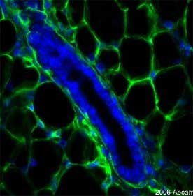 Immunohistochemistry (Formalin/PFA-fixed paraffin-embedded sections) - Anti-Collagen IV antibody (AB19808), expandable thumbnail