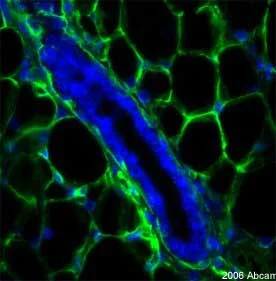 Immunohistochemistry (Formalin/PFA-fixed paraffin-embedded sections) - Anti-Collagen IV antibody (AB19808)
