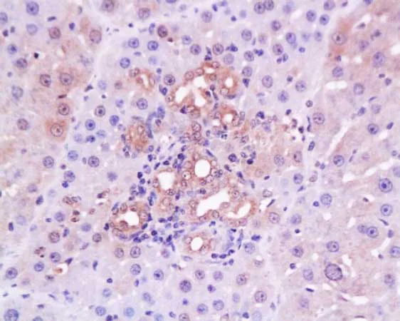 Immunohistochemistry (Formalin/PFA-fixed paraffin-embedded sections) - Anti-Collagen IV antibody (AB217147)