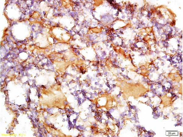 Immunohistochemistry (Formalin/PFA-fixed paraffin-embedded sections) - Anti-Collagen IV antibody (AB217147)