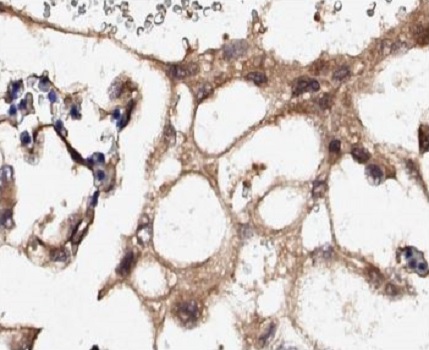 Immunohistochemistry (Formalin/PFA-fixed paraffin-embedded sections) - Anti-Collagen IV antibody (AB235296)