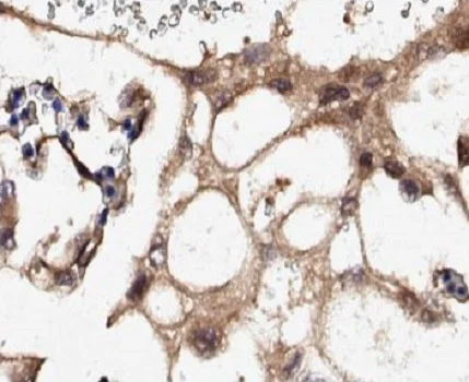 Immunohistochemistry (Formalin/PFA-fixed paraffin-embedded sections) - Anti-Collagen IV antibody (AB235296)