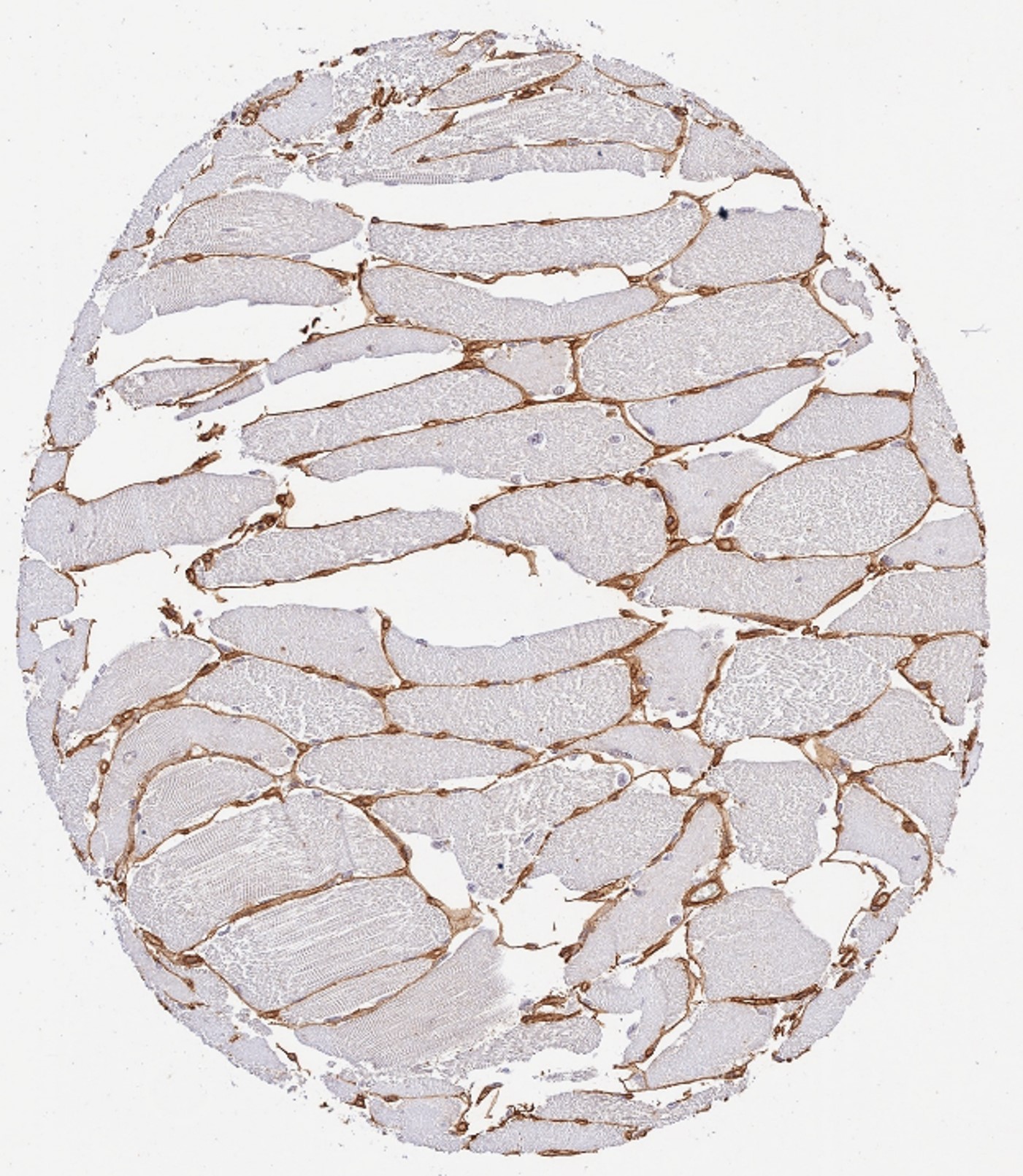 Immunohistochemistry (Formalin/PFA-fixed paraffin-embedded sections) - Anti-Collagen IV antibody (AB6586), expandable thumbnail