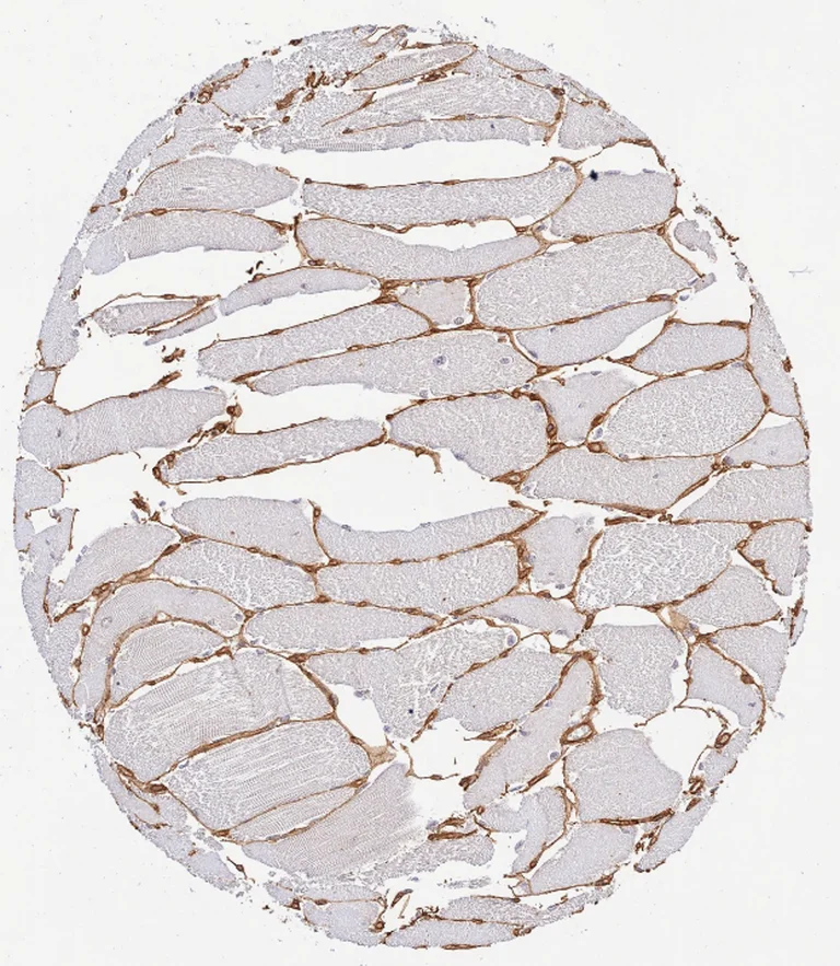 Immunohistochemistry (Formalin/PFA-fixed paraffin-embedded sections) - Anti-Collagen IV antibody (AB6586)