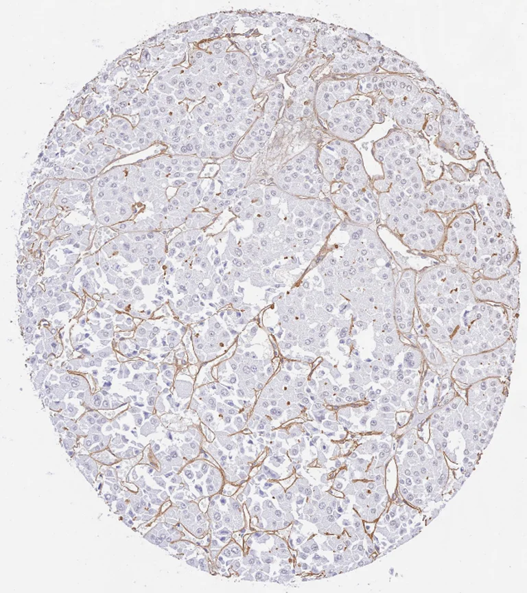Immunohistochemistry (Formalin/PFA-fixed paraffin-embedded sections) - Anti-Collagen IV antibody (AB6586)