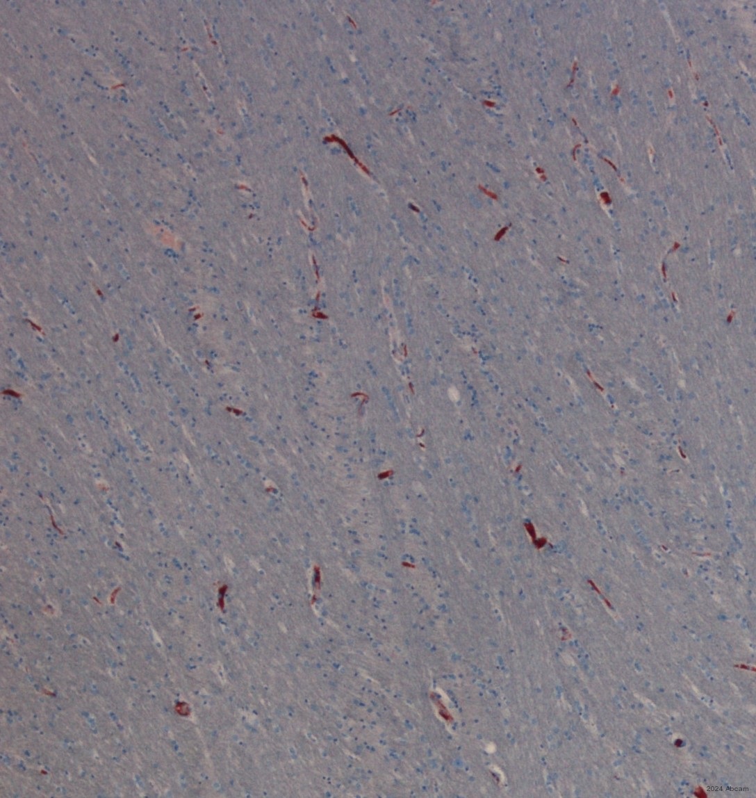 Immunohistochemistry (Formalin/PFA-fixed paraffin-embedded sections) - Anti-Collagen IV antibody (AB6586), expandable thumbnail