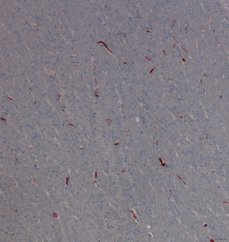 Immunohistochemistry (Formalin/PFA-fixed paraffin-embedded sections) - Anti-Collagen IV antibody (AB6586)